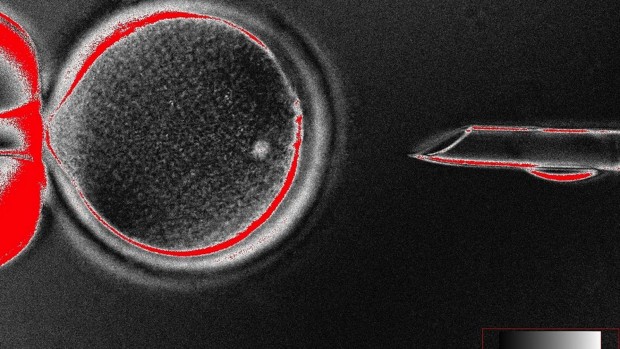 cloned-stem-cell